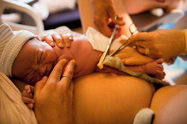新生儿脐部护理10个注意事项